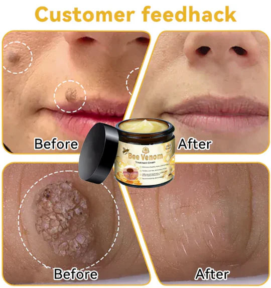 (Bee Venom)  TREATMENT CREMA