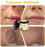 (Bee Venom)  TREATMENT CREMA