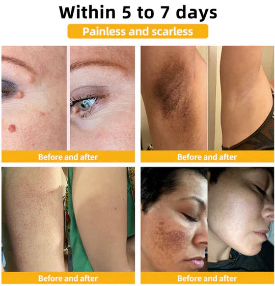 (Bee Venom)  TREATMENT CREMA