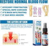 VARICOSE VEINS