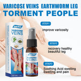 VARICOSE VEINS